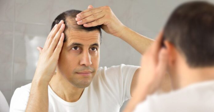 Understanding Hair Loss